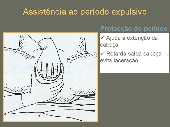 Assistência ao período expulsivo Protecção do períneo ü Ajuda a extenção da cabeça ü
