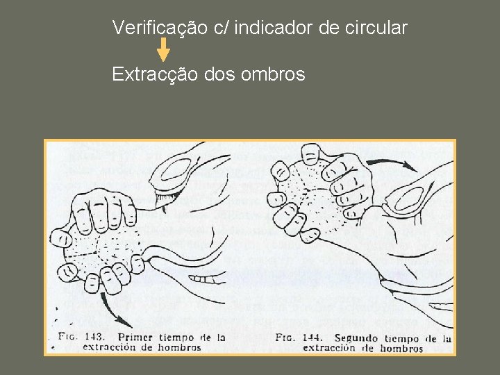 Verificação c/ indicador de circular Extracção dos ombros 