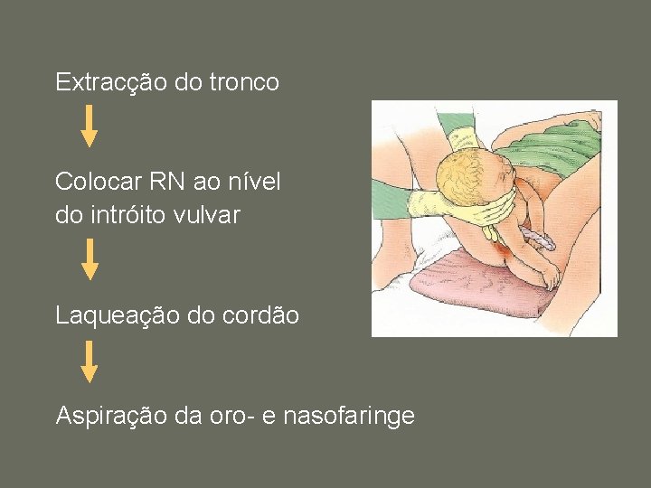 Extracção do tronco Colocar RN ao nível do intróito vulvar Laqueação do cordão Aspiração