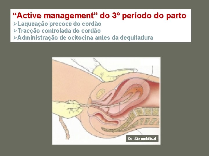 “Active management” do 3º período do parto ØLaqueação precoce do cordão ØTracção controlada do