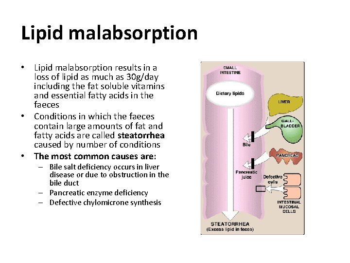 Lipid malabsorption • Lipid malabsorption results in a loss of lipid as much as