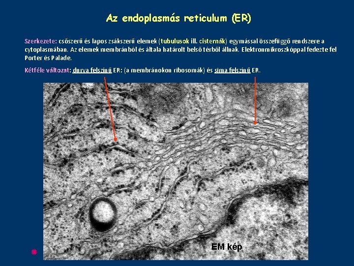 Az endoplasmás reticulum (ER) Szerkezete: csőszerű és lapos zsákszerű elemek (tubulusok ill. cisternák) egymással