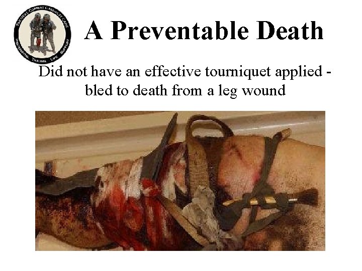 A Preventable Death Did not have an effective tourniquet applied bled to death from A Preventable Death Did not have an effective tourniquet applied bled to death from
