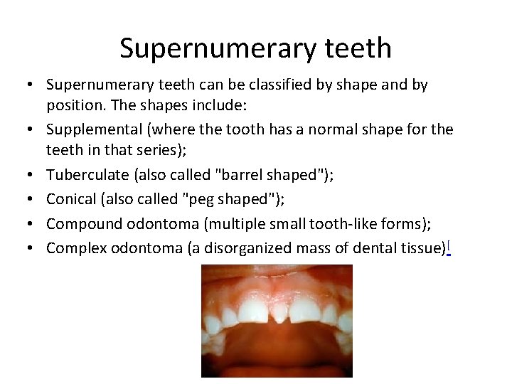 Supernumerary teeth • Supernumerary teeth can be classified by shape and by position. The