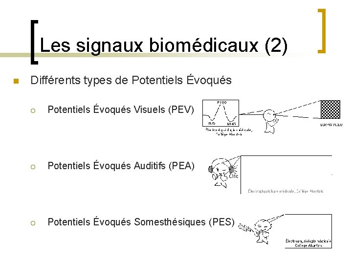 Les signaux biomédicaux (2) n Différents types de Potentiels Évoqués ¡ Potentiels Évoqués Visuels