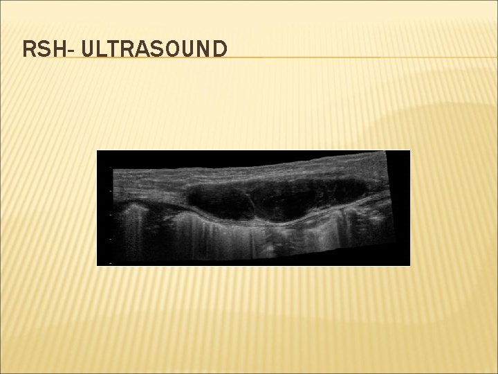 RSH- ULTRASOUND 