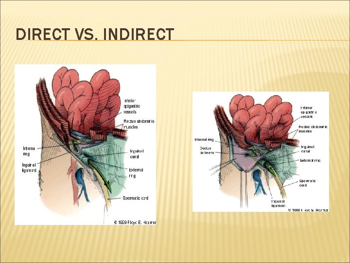 DIRECT VS. INDIRECT 