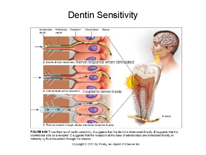 Dentin Sensitivity Nerve response when stimulated Coupled to nerves in pulp 