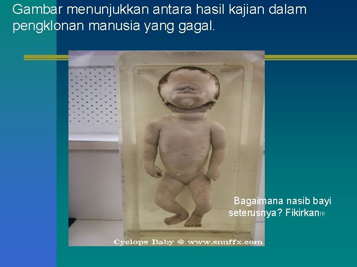 Gambar menunjukkan antara hasil kajian dalam pengklonan manusia yang gagal. Bagaimana nasib bayi seterusnya?