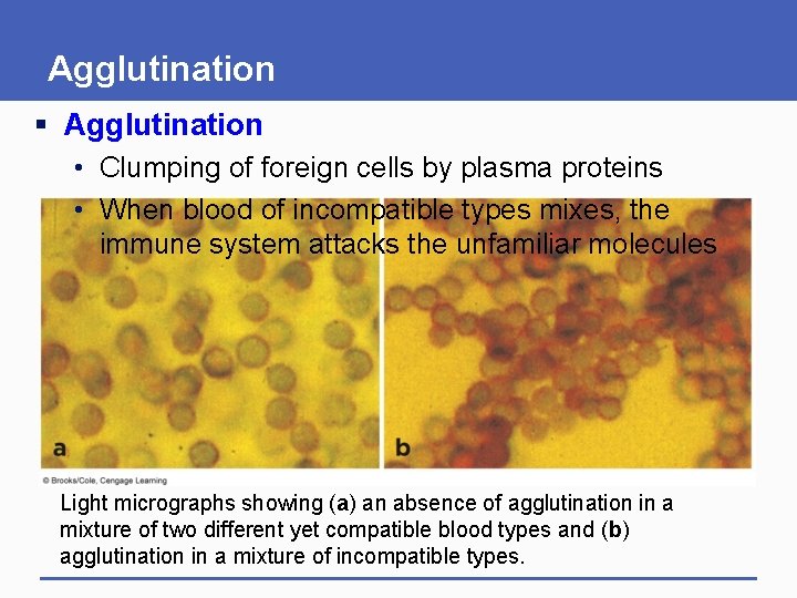 Agglutination § Agglutination • Clumping of foreign cells by plasma proteins • When blood