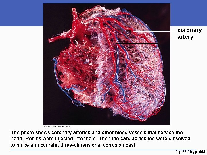 coronary artery The photo shows coronary arteries and other blood vessels that service the