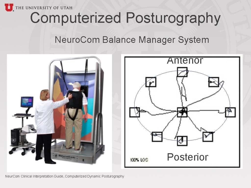 Computerized Posturography Neuro. Com Balance Manager System Anterior Posterior Neur. Com Clinical Interpretation Guide,