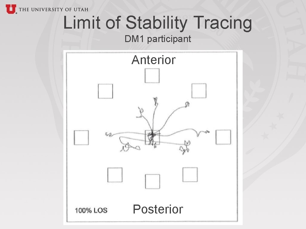 Limit of Stability Tracing DM 1 participant Anterior Posterior 