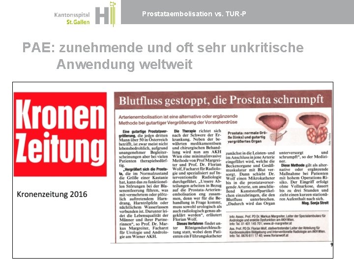 Prostataembolisation vs. TUR-P PAE: zunehmende und oft sehr unkritische Anwendung weltweit 