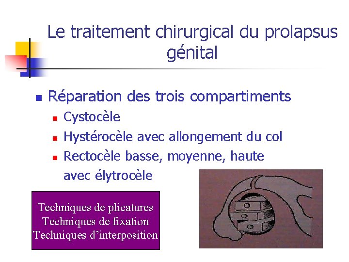 Le traitement chirurgical du prolapsus génital n Réparation des trois compartiments n n n