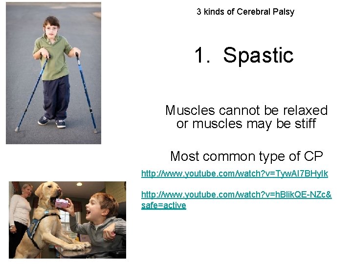 3 kinds of Cerebral Palsy 1. Spastic Muscles cannot be relaxed or muscles may