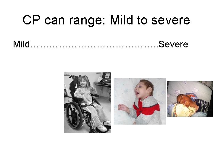 CP can range: Mild to severe Mild…………………. . Severe 