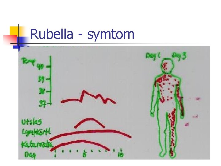 Rubella - symtom 