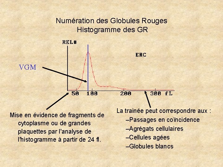 Numération des Globules Rouges Histogramme des GR VGM Mise en évidence de fragments de Numération des Globules Rouges Histogramme des GR VGM Mise en évidence de fragments de