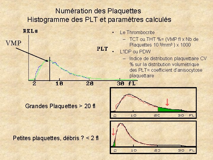 Numération des Plaquettes Histogramme des PLT et paramètres calculés • VMP • Grandes Plaquettes Numération des Plaquettes Histogramme des PLT et paramètres calculés • VMP • Grandes Plaquettes