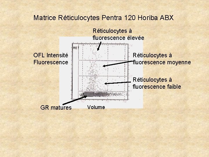 Matrice Réticulocytes Pentra 120 Horiba ABX Réticulocytes à fluorescence élevée OFL Intensité Fluorescence Réticulocytes Matrice Réticulocytes Pentra 120 Horiba ABX Réticulocytes à fluorescence élevée OFL Intensité Fluorescence Réticulocytes