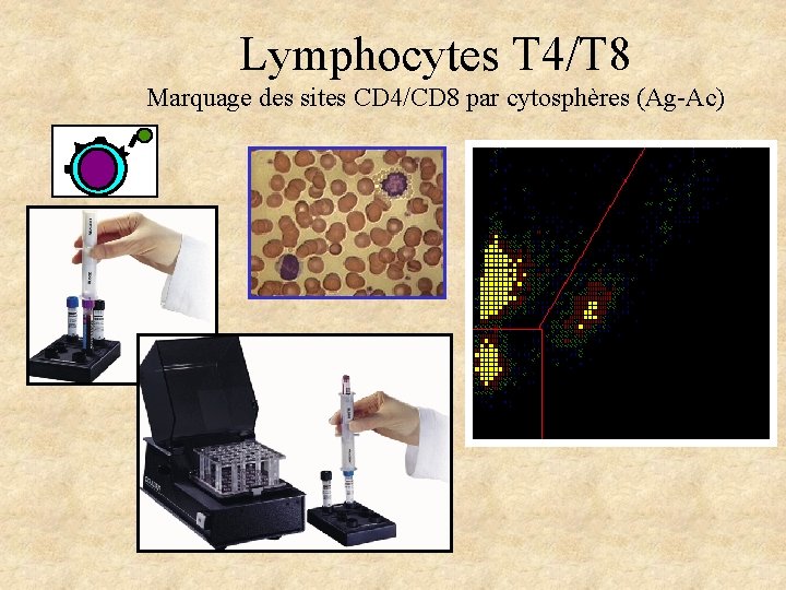 Lymphocytes T 4/T 8 Marquage des sites CD 4/CD 8 par cytosphères (Ag-Ac) Lymphocytes T 4/T 8 Marquage des sites CD 4/CD 8 par cytosphères (Ag-Ac)