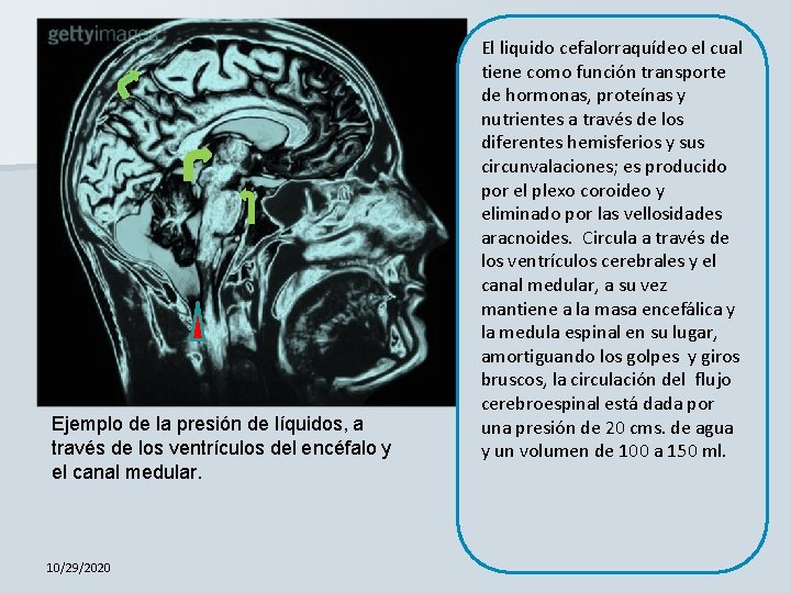 Ejemplo de la presión de líquidos, a través de los ventrículos del encéfalo y