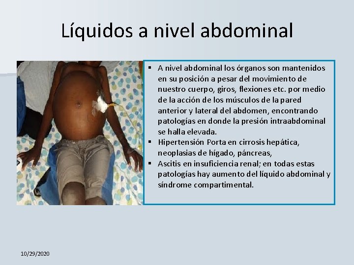 Líquidos a nivel abdominal § A nivel abdominal los órganos son mantenidos en su