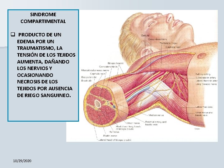 SINDROME COMPARTIMENTAL q PRODUCTO DE UN EDEMA POR UN TRAUMATISMO, LA TENSIÓN DE LOS