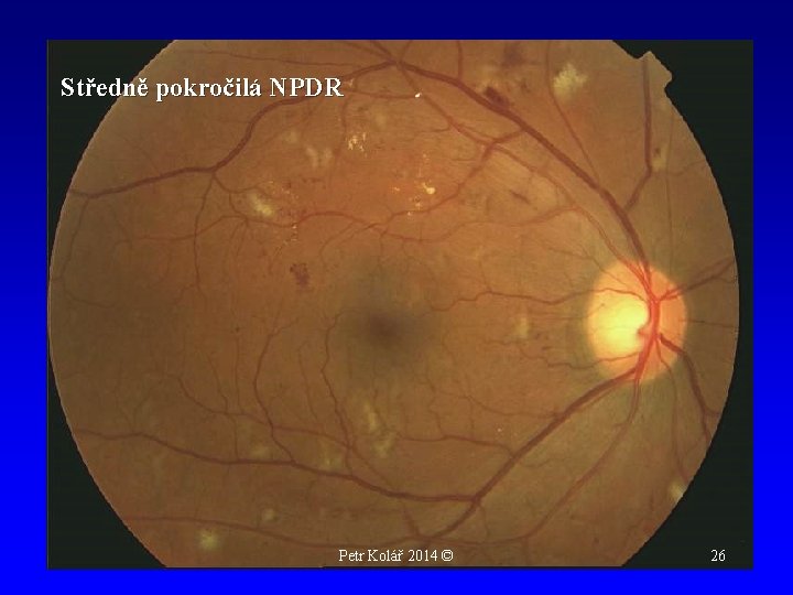 Středně pokročilá NPDR Petr Kolář 2014 © 26 