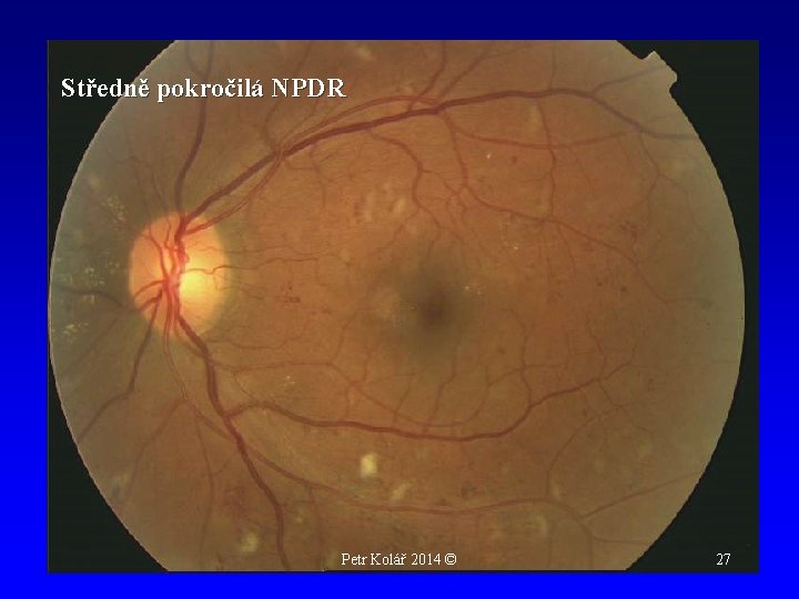 Středně pokročilá NPDR Petr Kolář 2014 © 27 
