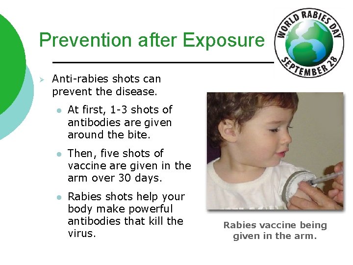 Prevention after Exposure Ø Anti-rabies shots can prevent the disease. l At first, 1