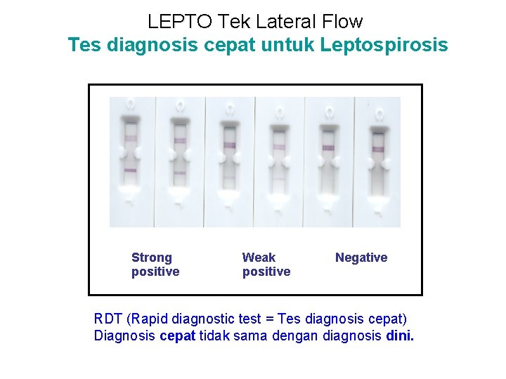 LEPTO Tek Lateral Flow Tes diagnosis cepat untuk Leptospirosis Strong Weak Negative positive RDT