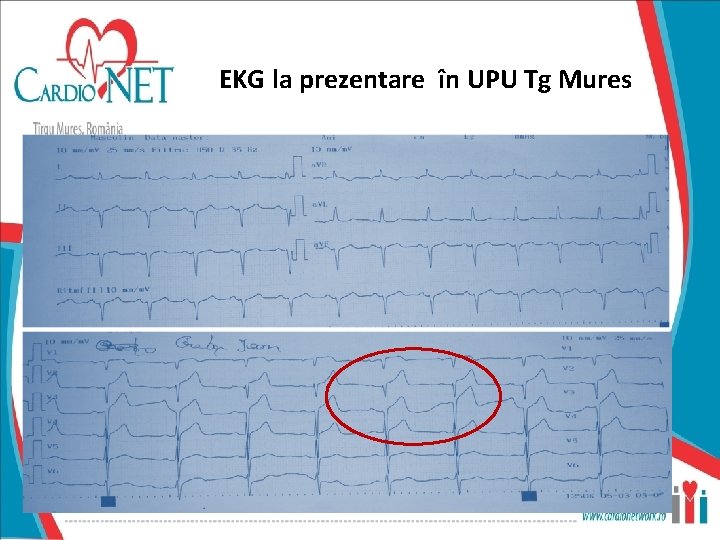 EKG la prezentare în UPU Tg Mures 