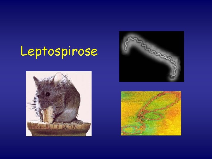 Leptospirose 