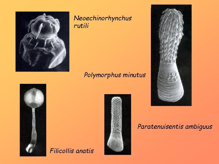 Neoechinorhynchus rutili Polymorphus minutus Paratenuisentis ambiguus Filicollis anatis 