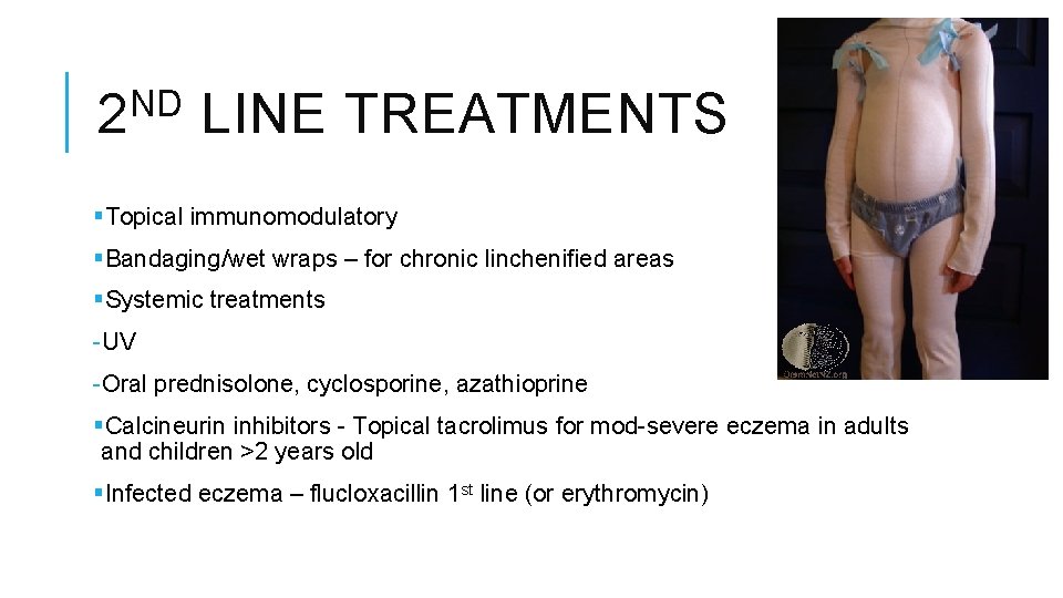 ND 2 LINE TREATMENTS §Topical immunomodulatory §Bandaging/wet wraps – for chronic linchenified areas §Systemic