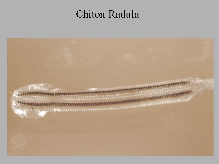 Chiton Radula 