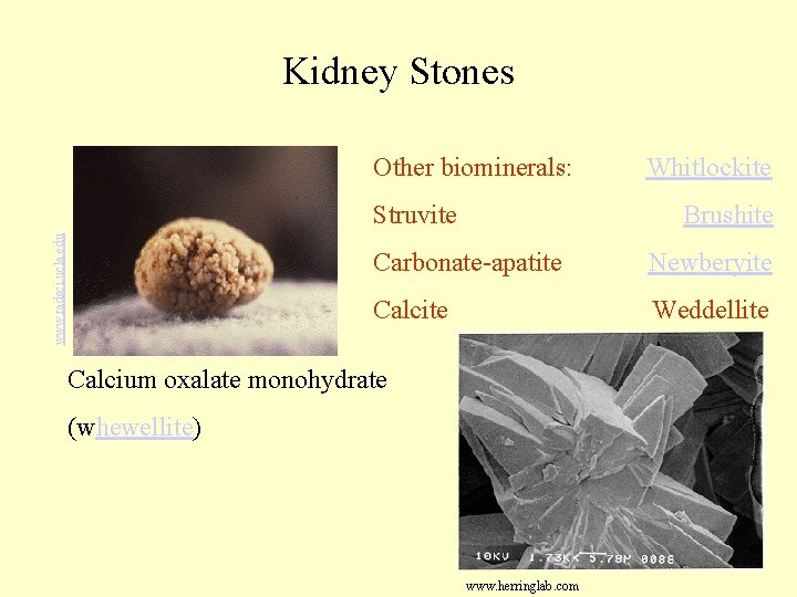 Kidney Stones Other biominerals: Whitlockite www. radsci. ucla. edu Struvite Brushite Carbonate-apatite Newberyite Calcite