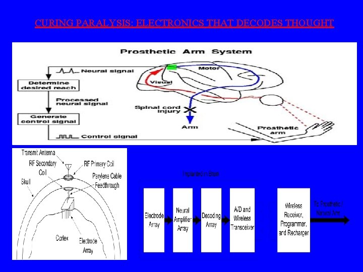 CURING PARALYSIS: ELECTRONICS THAT DECODES THOUGHT 