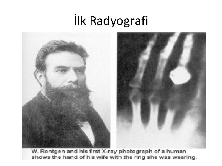 İlk Radyografi 