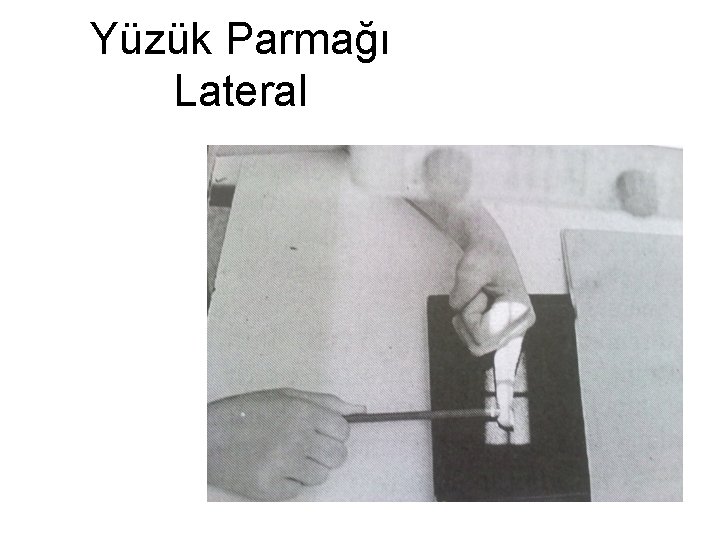 Yüzük Parmağı Lateral 