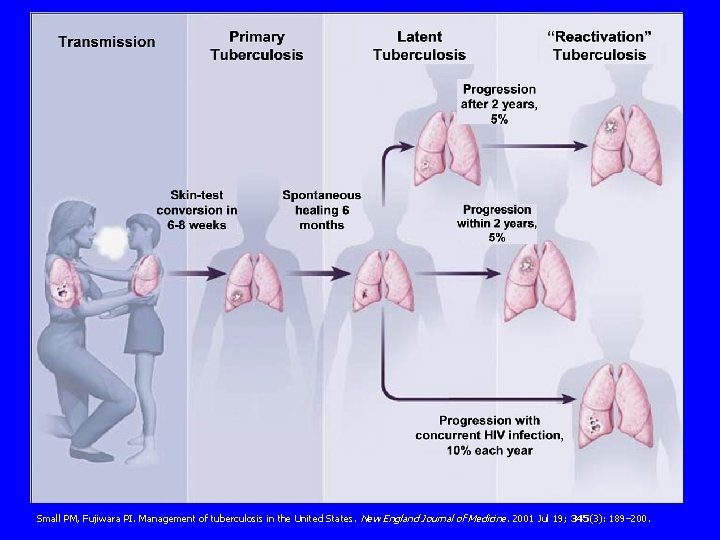 Natural History of TB Infection Small PM, Fujiwara PI. Management of tuberculosis in the