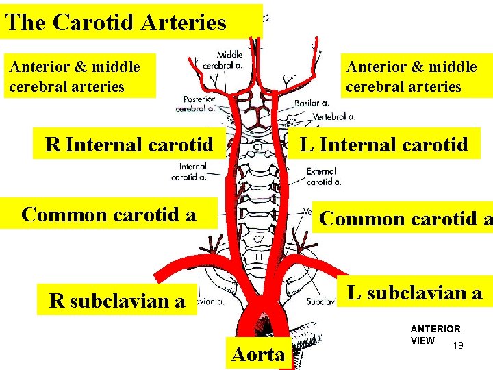 The Carotid Arteries Anterior & middle cerebral arteries R Internal carotid L Internal carotid