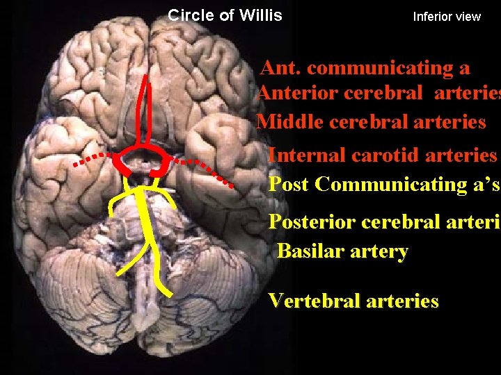 Circle of Willis Inferior view Ant. communicating a Anterior cerebral arteries Middle cerebral arteries