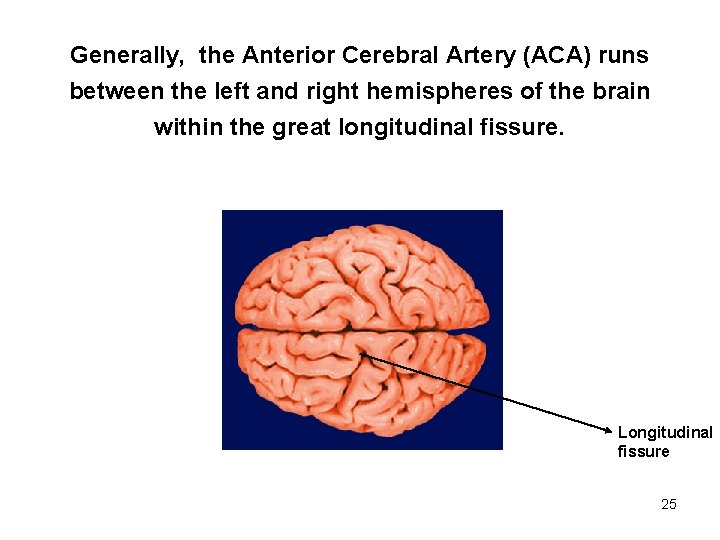 Generally, the Anterior Cerebral Artery (ACA) runs between the left and right hemispheres of