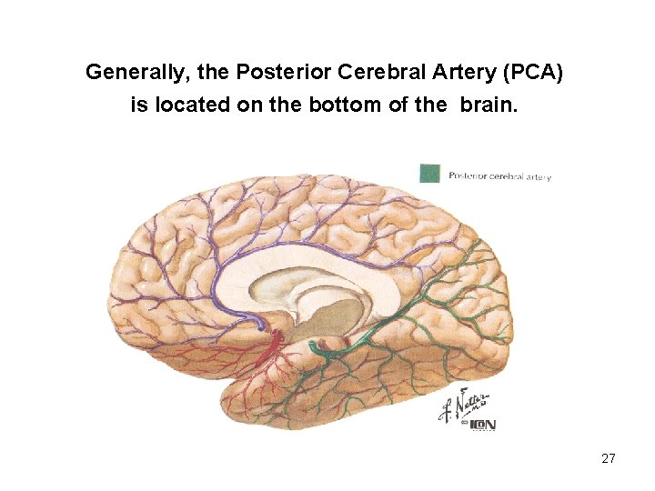 Generally, the Posterior Cerebral Artery (PCA) is located on the bottom of the brain.
