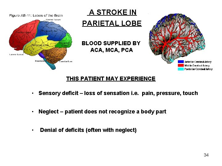 A STROKE IN PARIETAL LOBE BLOOD SUPPLIED BY ACA, MCA, PCA THIS PATIENT MAY