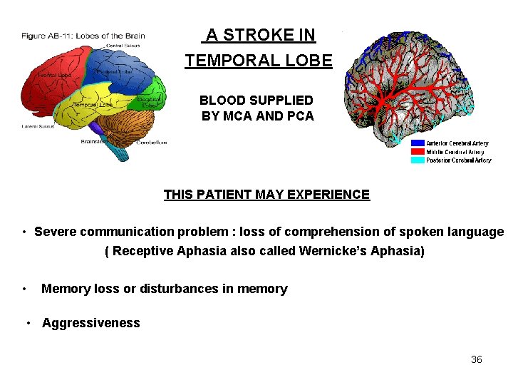 A STROKE IN TEMPORAL LOBE BLOOD SUPPLIED BY MCA AND PCA THIS PATIENT MAY