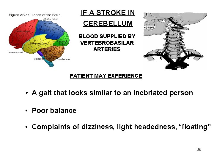 IF A STROKE IN CEREBELLUM BLOOD SUPPLIED BY VERTEBROBASILAR ARTERIES PATIENT MAY EXPERIENCE •